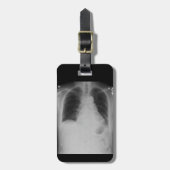 Chest X Ray ~ Bagagelabel (Voorkant verticaal)