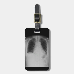 Chest X Ray ~ Bagagelabel