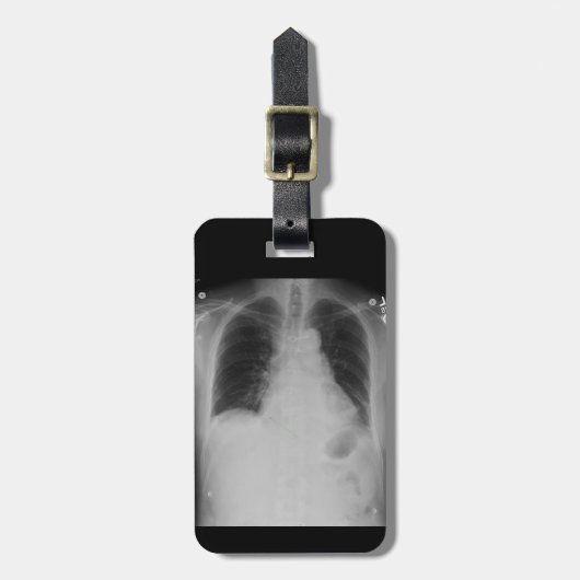 Chest X Ray ~ Bagagelabel (Voorkant verticaal)