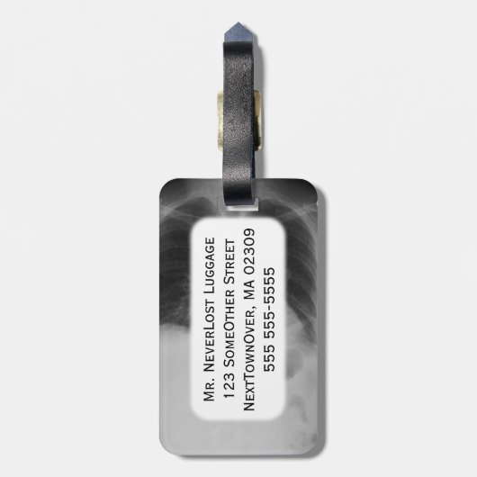 Chest X Ray ~ Bagagelabel (Achterkant verticaal)