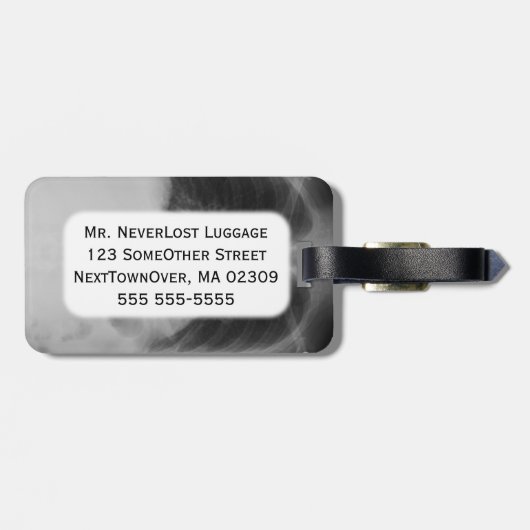 Chest X Ray ~ Bagagelabel (Achterkant horizontaal)