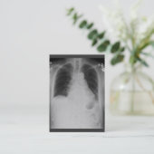 Chest X Ray ~ Chubby Visitekaartje (Staand voorkant)