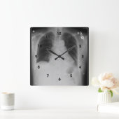Chest X Ray ~ Clock Vierkante Klok (Huis)