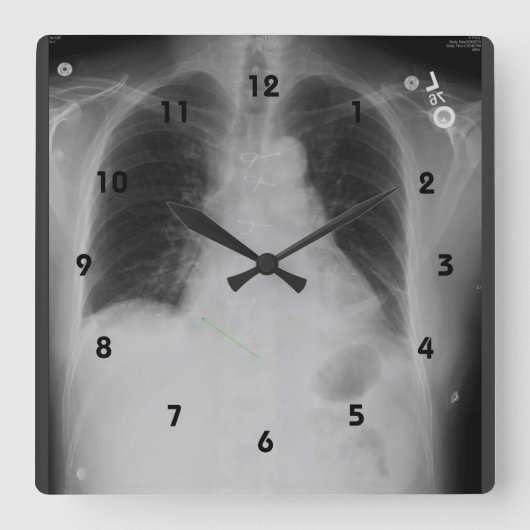 Chest X Ray ~ Clock Vierkante Klok (Voorkant)