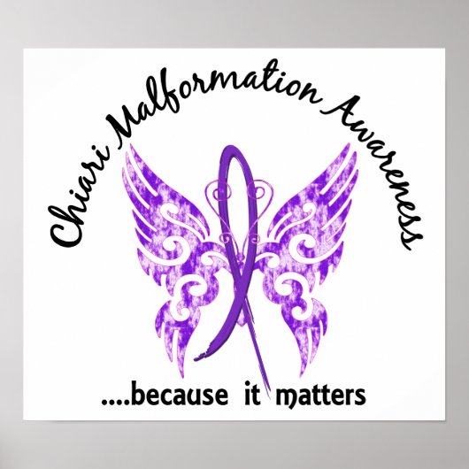 Chiari Malformation Butterfly 6.1 Poster (Voorkant)
