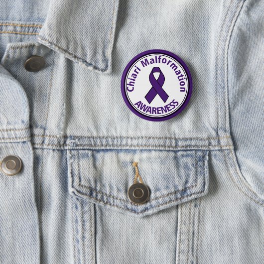 Chiari Malformation Paarse Awareness Ribbon Button (In situ)