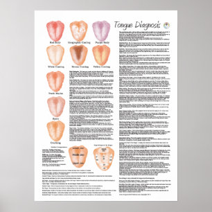 Chinees tongdiagnostiek Acupunctie Poster