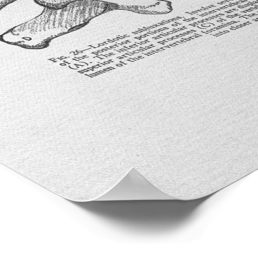 Chiropractic Subluxation Vintage Print (Hoek)