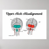 Chiropractic Upper Cervical Poster (Voorkant)