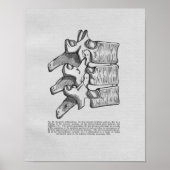 Chiropractische subluxe  afdruk poster (Voorkant)