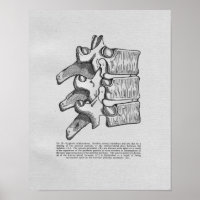 Chiropractische subluxe afdruk