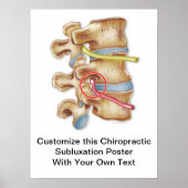 Chiropractische subluxe Poster aanpassen (Voorkant)
