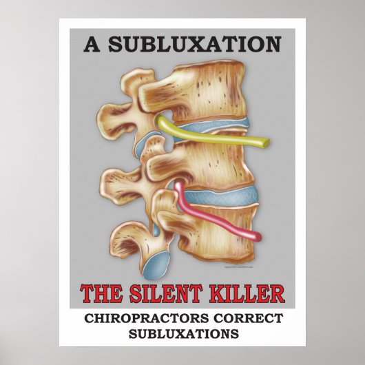 Chiropraktijk Subluxation Silent Killer Poster (Voorkant)