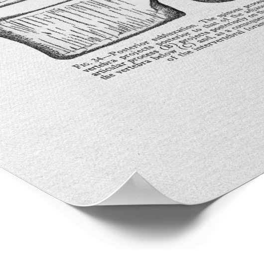 Chiropraktijkvertebrale subluxe  afdruk poster (Hoek)