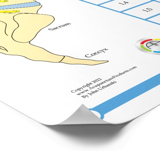 Chiropraktijkvertebrale subluxe Poster (Hoek)