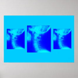 Chiropraktisch Poster: Laterale cervicale vervagen Poster