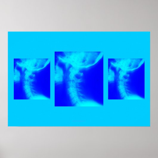 Chiropraktisch Poster: Laterale cervicale vervagen Poster (Voorkant)