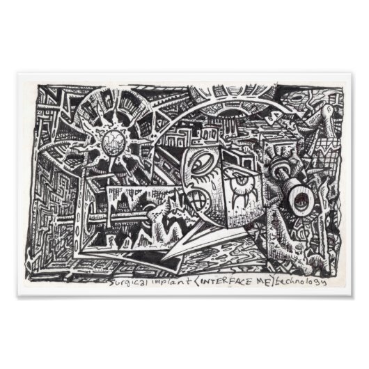 Chirurgische implantatie- (Interface Me)-technolog Foto Afdruk (Voorkant)