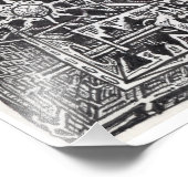 Chirurgische implantatie- (Interface Me)-technolog Foto Afdruk (Hoek)