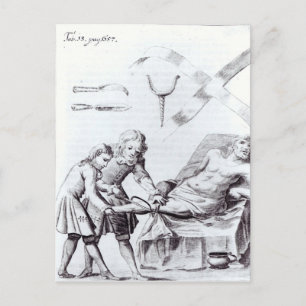 Chirurgische ingreep om een been te amputeren briefkaart