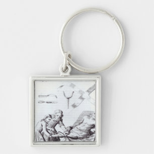 Chirurgische ingreep om een been te amputeren sleutelhanger