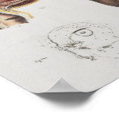 Chirurgische medische techniek  anatomische afdruk poster (Hoek)