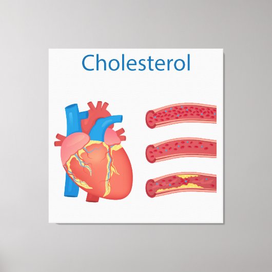 Cholesterol Canvas Afdruk (Voorkant)