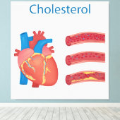 Cholesterol Canvas Afdruk (Insitu (Houten vloer))