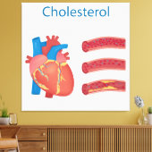Cholesterol Canvas Afdruk (Insitu (Woonkamer))