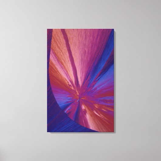 Cholesterolkristallen Canvas Afdruk (Voorkant)