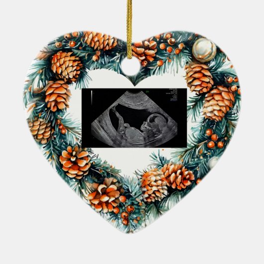 Christmas Pregnancy Ultrasound  Baby On The Way  Keramisch Ornament (Achterkant)