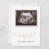 Citrus Zwangerschap Aankondiging Baby (Achterkant)