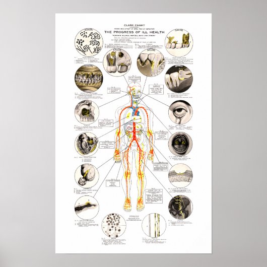 Clark Dental Health Chart voor Dentist Poster (Voorkant)