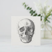 Classic Skull Diagram Illustratie Kaart (Staand voorkant)