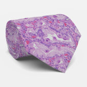 CMV Endocervicitis Stropdas (Opgerold)