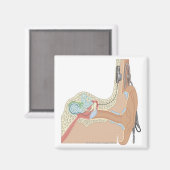 Cochlear Implantaten Magneet (Voorkant / Achterkant)