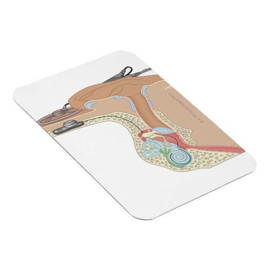 Cochlear Implantaten Magneet (Rechterzijde)