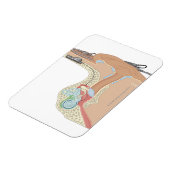 Cochlear Implantaten Magneet (Linkerzijde)