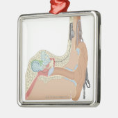 Cochlear Implantaten Metalen Ornament (Links)