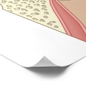 Cochlear Implantaten Poster (Hoek)