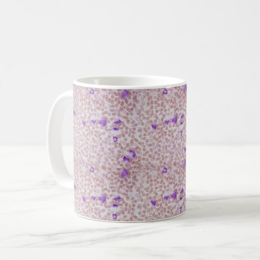 Coffee Mok - Chronische myeloïde leukemie (CML) (Voorkant links)