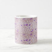 Coffee Mok - Chronische myeloïde leukemie (CML) (Center)