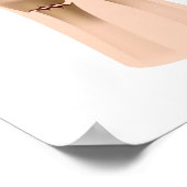 Colles fracture, medische illustratie. poster (Hoek)