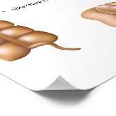 Colon pathologies-Poster Poster (Hoek)