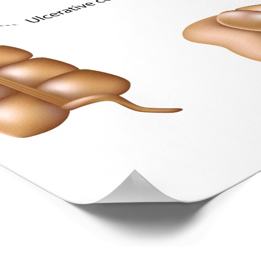 Colon pathologies-Poster Poster (Hoek)