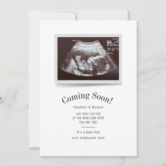 Coming Soon Ultrasound Photo Scan Baby Reveal Aankondiging (Voorkant)