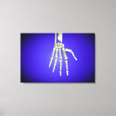 Conceptueel Afbeelding van Botten in de hand 2 Canvas Afdruk (Voorkant)