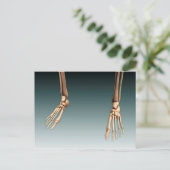 Conceptueel Afbeelding van Botten in de menselijke Briefkaart (Staand voorkant)