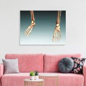 Conceptueel Afbeelding van Botten in de menselijke Canvas Afdruk (Insitu (Woonkamer))