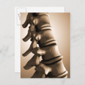 Conceptueel Afbeelding van de menselijke ruggengra Briefkaart (Voorkant / Achterkant)